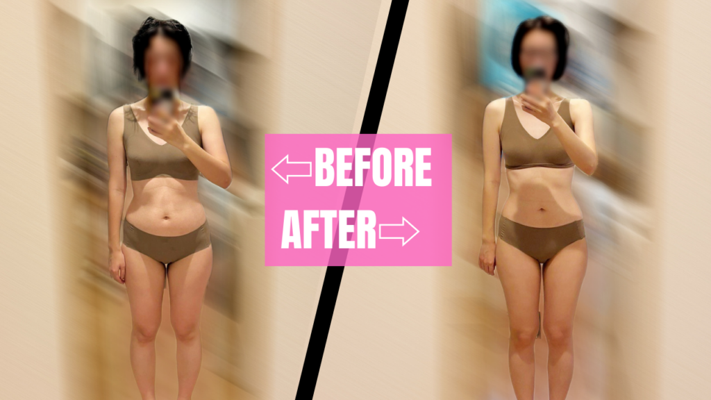 30代女性ビフォーアフター